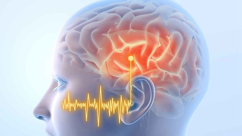 Auditorybrain Apd Capd 1200 X 675