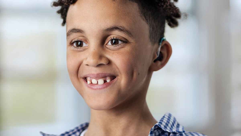 Sky Lumity hearing aids incorporate cutting-edge technology designed exclusively for kids, prioritizing speech understanding in noise.