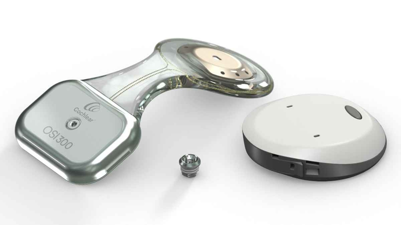 Cochlear Osia Osi 300 Implant
