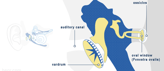 Conductive hearing loss representation