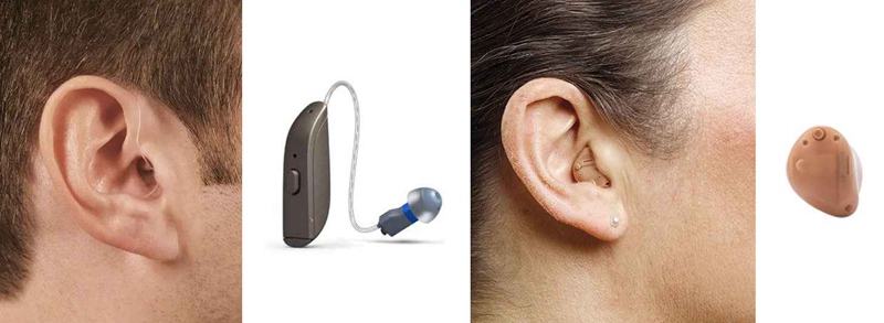 Open vs Closed Hearing Aids
