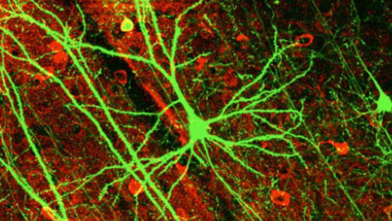 Deep neural networks, or DNNs, attempt to mimic neurons (shown above) in the human brain through a combination of data inputs, weights, and bias. These elements work together to recognize, classify, and describe objects within the data.